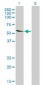 TROVE2 Antibody (monoclonal) (M03)